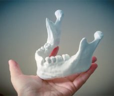 3d printing in dental